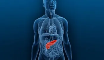 Tratar el cáncer de páncreas con electrodos