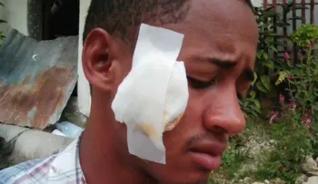 Familiares de joven denuncian fue golpeado por policías en Los Alcarrizos