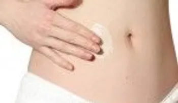 ¡Buenas nuevas! Consejos para evitar las estrías en tu cuerpo