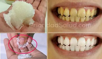Esta es la mejor receta para blanquear tus dientes amarillos; no será necesario la pasta dental