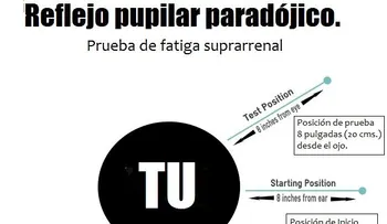  La causa real de la fatiga adrenal no es lo que piensas 