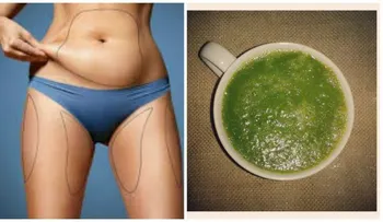 Médico naturista recomendó este remedio a una amiga. En 1 mes resultó mejor que hacerse una cirugía