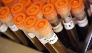 Sin salvación posible: ¿Qué haremos cuando llegue el  armagedón de los antibióticos?