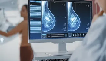 Salud Pública reporta unos 2,609 diagnósticos anuales de cáncer de mama en República Dominicana