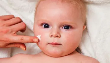Uno de cada cuatro niños puede padecer dermatitis atópica