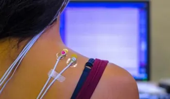 Qué es la electromiograma