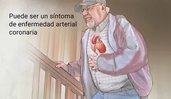 ¿Cuáles son los signos y síntomas de la angina?