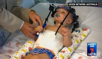 Médicos australianos le salvan la vida a niño que había sido decapitado internamente