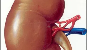 Pone en venta uno de sus riñones para mantener a sus hijos 