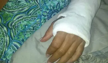 Una mujer denuncia fue golpeada brutalmente por su ex pareja