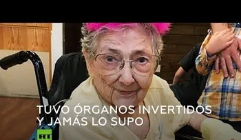 Acudió al médico por una tos, y tenía su corazón a la derecha y el hígado a la izquierda 