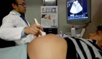 El zika puede causar microcefalia en 1 de cada 100 embarazos