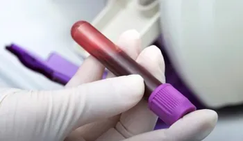 Evaluación sanguínea es clave para detectar la hemofilia 