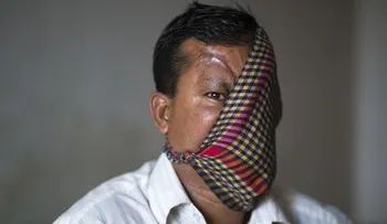 El hombre destrozado por un tigre muestra sus heridas 20 años después
