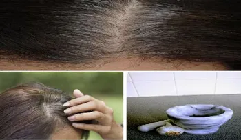 Sólo toma 5 minutos para eliminar las canas, hacer que el cabello vuelva a crecer y evitar que se caiga