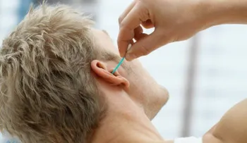 ¿Limpiar o no el cerumen de los oídos? Los médicos explican