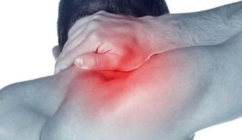 Tortícolis: por qué ocurre y duele tanto 