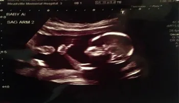 Un feto de 18 semanas levanta el pulgar haciendo el gesto de OK