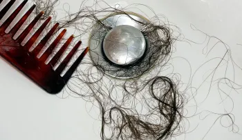 Champú natural con ajo para la caída del pelo