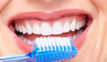 4 preguntas que debes hacer a tu dentista