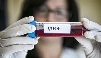 Un estudio francés abre una puerta para acabar con el VIH
