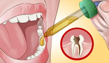 Mi dentista estaba sorprendido cuando le dije que esto me quitó el dolor de muelas ¡no lo podía creer!