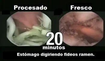 Peligros de los fideos ramen comerciales