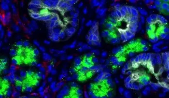 Investigadores de Clínica Mayo identifican primeros pasos en formación del cáncer de páncreas