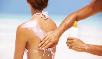 Controla la exposición al sol durante los últimos días de vacaciones