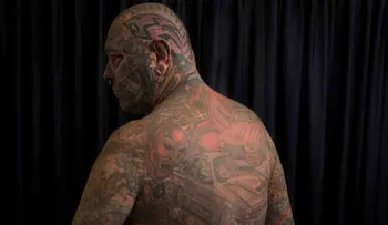 Un hombre se tatuó hasta el pene y el ojo para combatir su dolor crónico