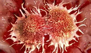  Desinformación y síntomas confusos retrasan diagnóstico de cáncer de próstata 
