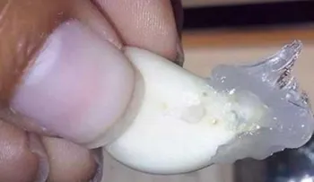 Te lamentarás por siempre si no untas un diente de ajo con Vick VapoRub, este es el mejor remedio