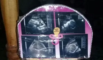 Mujer que esperaba dar a luz gemelas recibió solo una bebé en un hospital de Argentina