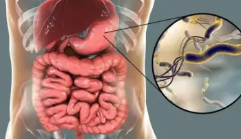 Estudio revela la gran resistencia de la Helicobacter pylori a los antibióticos