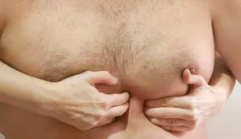 5 remedios naturales para la hernia de hiato