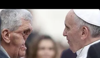El papa abraza a un hombre con el rostro completamente desfigurado
