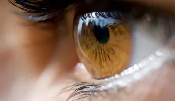 Edema macular suele asociarse a la Diabetes