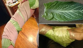 Envuelva su pierna durante 1 hora con col y esto sucederá en sus articulaciones