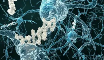 ¿Desea que su cerebro sea sano? Lleve una vida sana