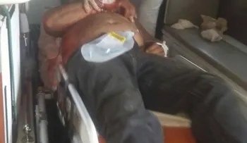 Mujer apuñala hombre que se negó a pagar cervezas 