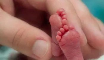 Estadística de recién nacidos prematuros es un problema de salud mundial
