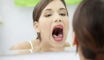 Desordenes alimenticios también arruinan tu sonrisa