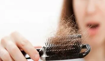 ¿Por qué se nos puede caer el cabello?