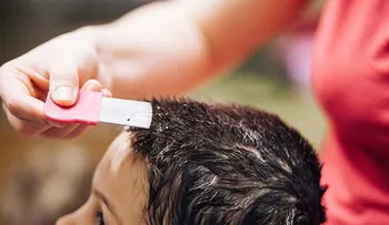 Cómo usar el vinagre para eliminar piojos y las liendres 