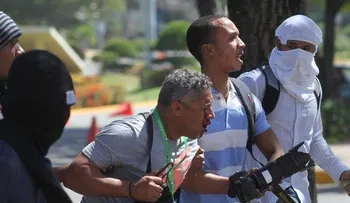 Fotógrafo Danny Polanco recupera parcialmente visión de ojo afectado