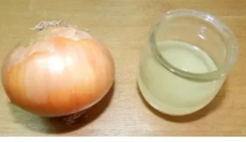 5 importantes remedios para acelerar el crecimiento del cabello y parar su caída