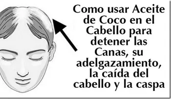 Increible aceite que hace desaparecer la calvicie y combate la caspa. Crece el cabello desde la primera aplicación