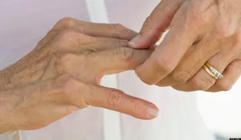 Remedios naturales contra la artritis
