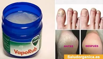 Por qué nadie me lo había dicho: 13 usos increíbles del VICKS VAPORUB