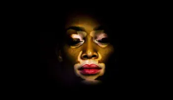 De ser llamada 'vaca' a chica de portada, la modelo Winnie Harlow cambia los estándares de belleza